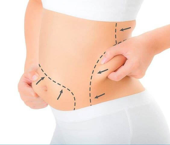 al Diseases Abdominoplasty